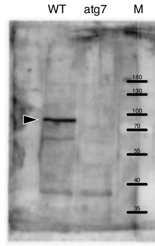 Western blot using anti-ATG7 antibodies